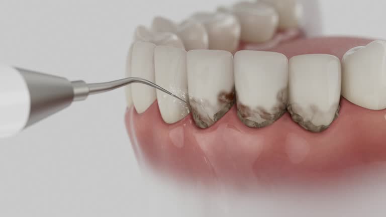 Reliable Dental contractor in Crystal River, FL by Smile Center Dentistry